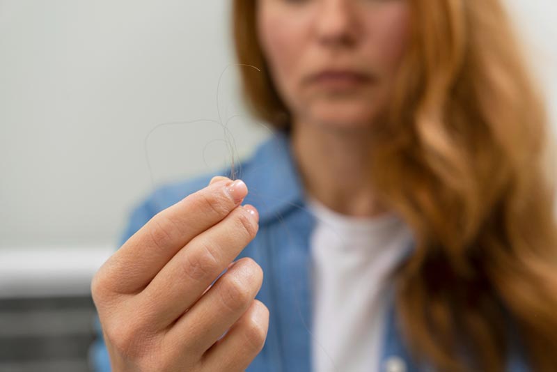 Tricotiloman�a: Un Desorden Psicol�gico